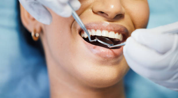 Best Emergency Broken Tooth Repair in Laurel Hollow, NY
